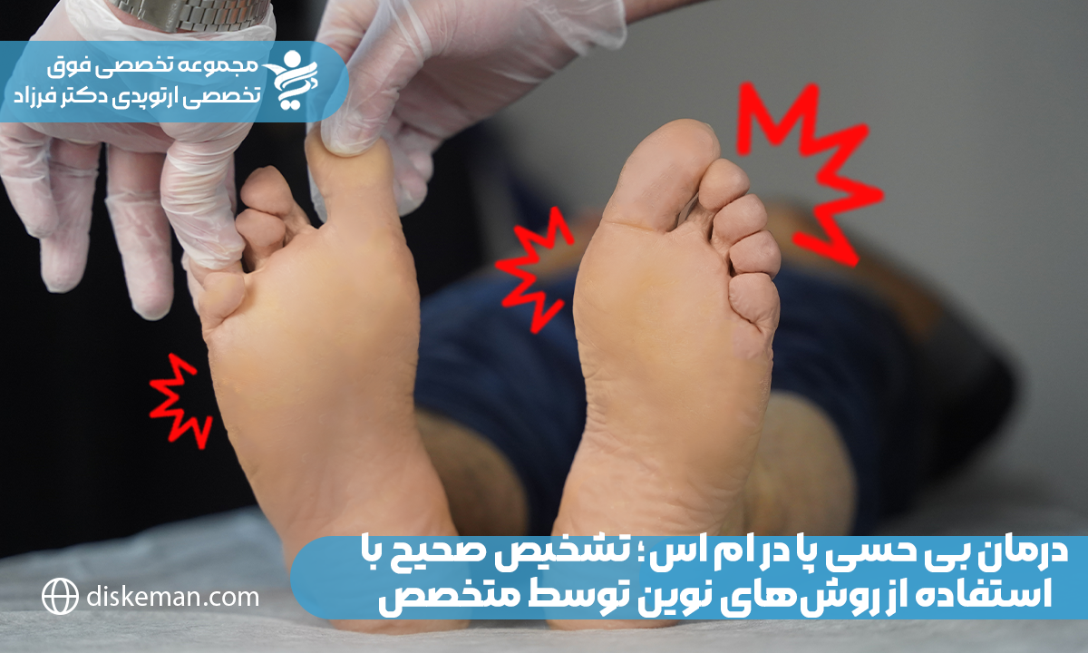 درمان بی حسی پا در ام اس؛ تشخیص صحیح با استفاده از روش‌های نوین توسط متخصص 